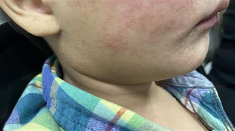 Public health leaders urge vaccination in Oregon’s largest .